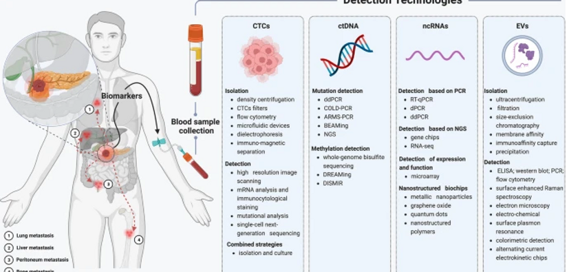 Emerging Technologies in the Diagnosis and Treatment of Pancreatic Cancer